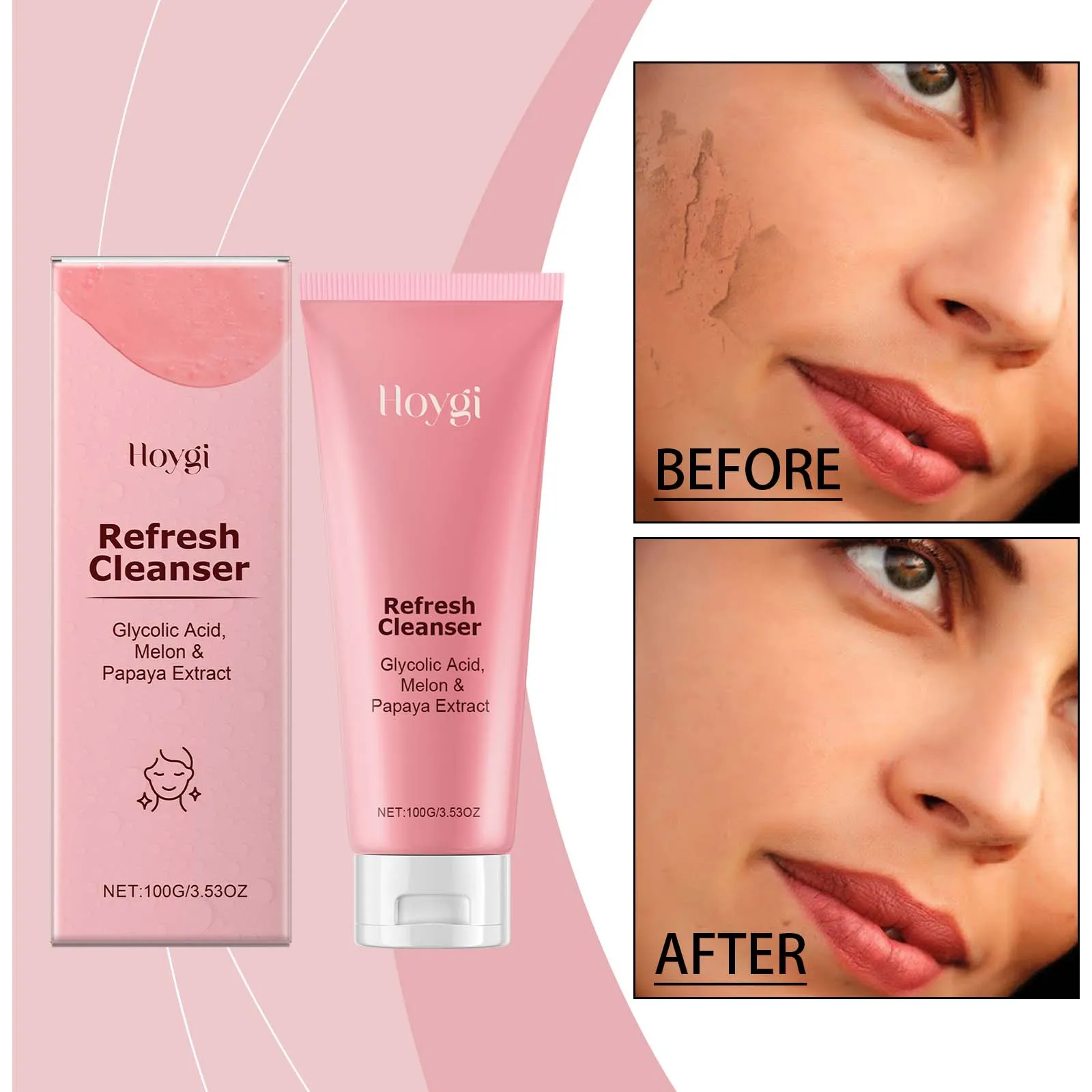 Glycolic Acid Face Cleanser with Melon & Papaya Extract - Exfoliating & Brightening Wash | 100g"
