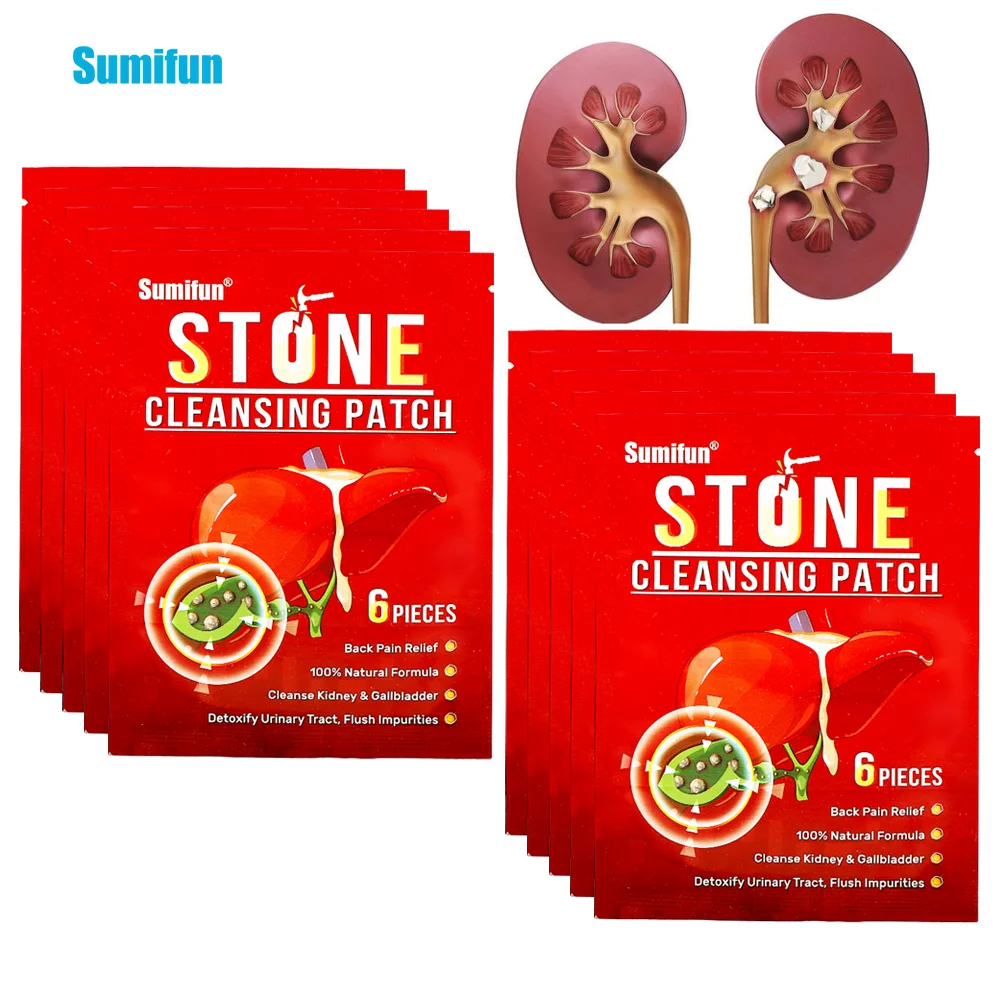 6-60Pcs Sumifun Stone Cleansing Patch Remove Gallstones Kidney Stones Sticker Renal Calculus Body Pain Detox Health Care Plaster