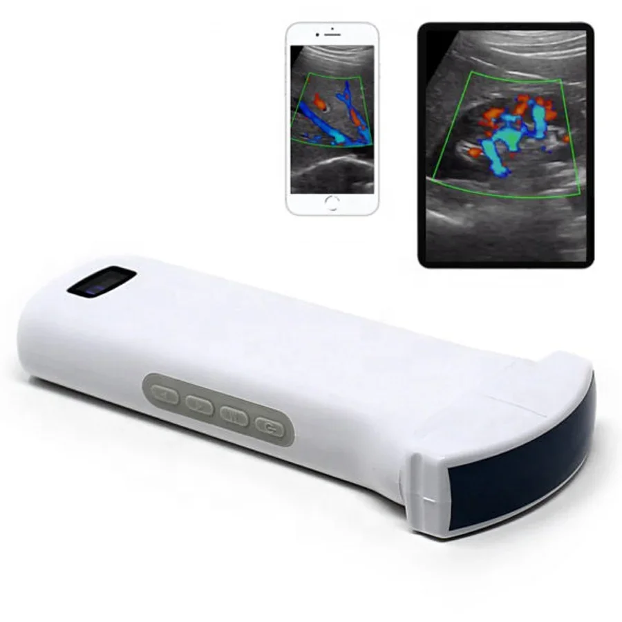 MT Medical Veterinary Equipment Handle Portable Wireless Animal Vet Ultrasound Dog Pregnancy Scanner System