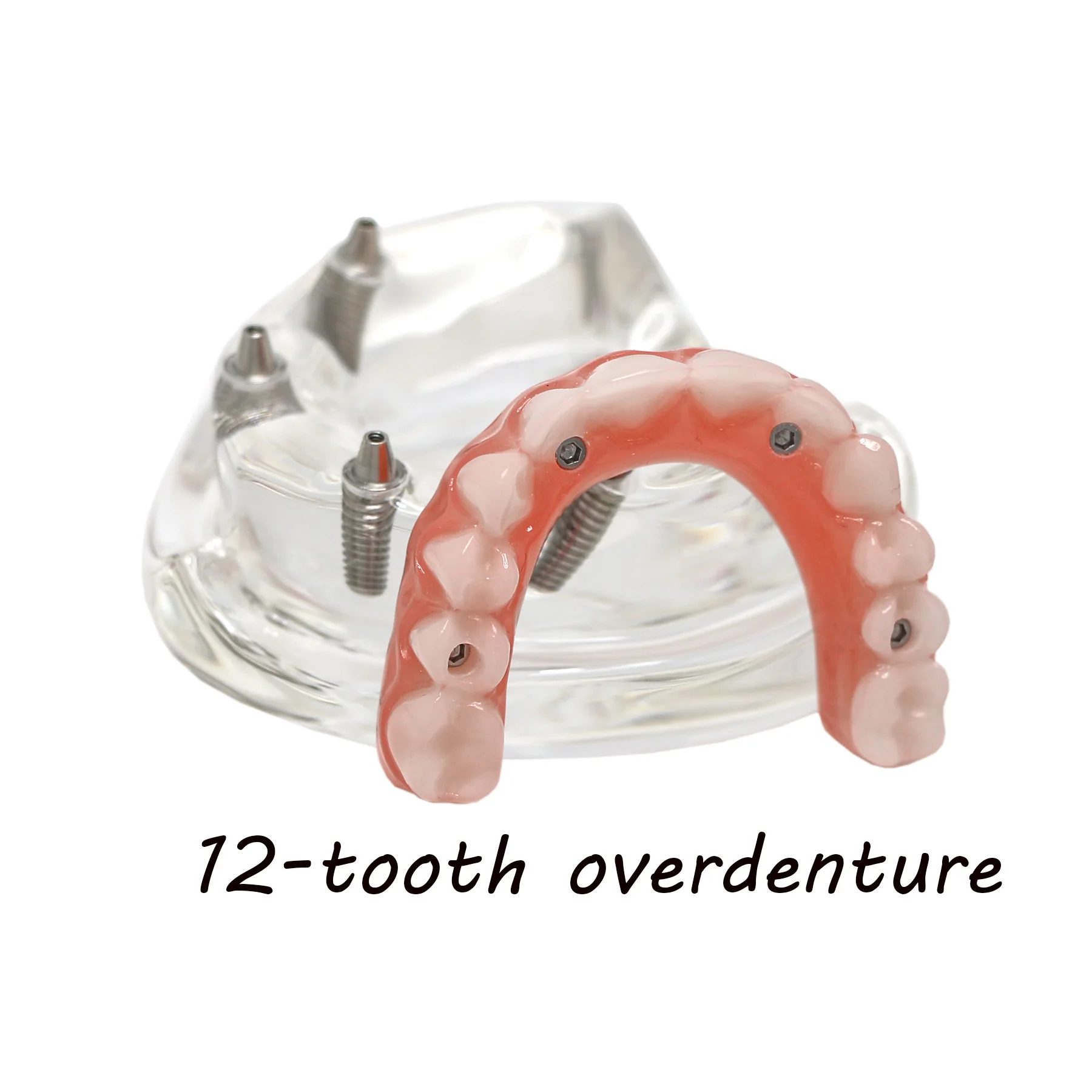 

Dental Implant Teeth Model 4 Removable Screws All on 4 Transparent Upper Jaw Type Overdenture Modle M6001-1