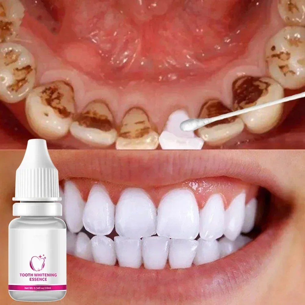 

Teeth Whitening Serum Remove Plaque Stains Bleachig Teeth Essence Oral Hygiene Cleaning Gel Fresh Breath Care Dental Tools