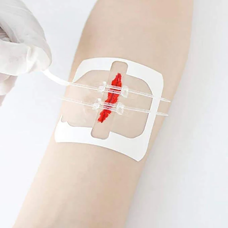 2 Tas Strip Penutup Luka Dasi Ritsleting Medis Perekat Hemostatik Tanpa Rasa Sakit Gratis Jahitan Pita Darurat Ritsleting Perban Bantuan