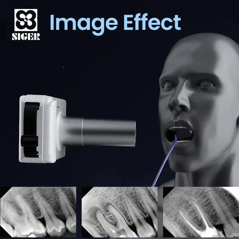 Sensor de Raio-X Digital Intraoral, Tecnologia Dental Inteligente, Sistema de Imagem APS CMOS Avançado para Alta Sensibilidade, SIGER Pluto 0001X