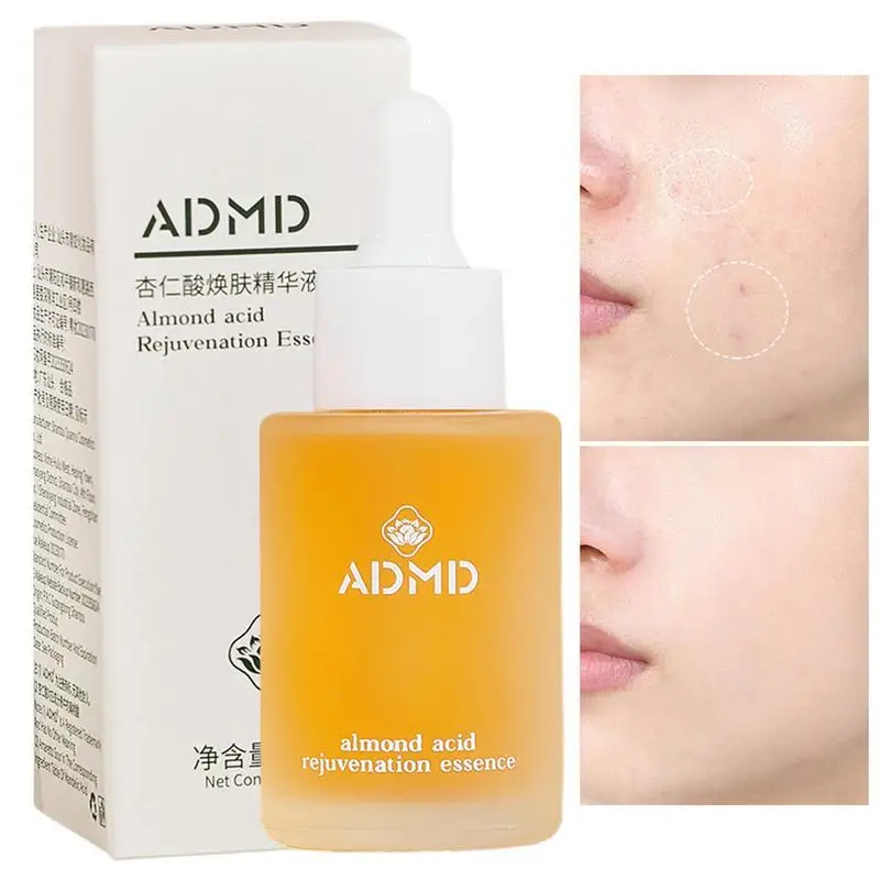 Mandelic Acid Essence Shrink Pores Remove Blackheads Oil Control Serum Moisturizing Smooth Skin Care Acid Acne Treatments Serum