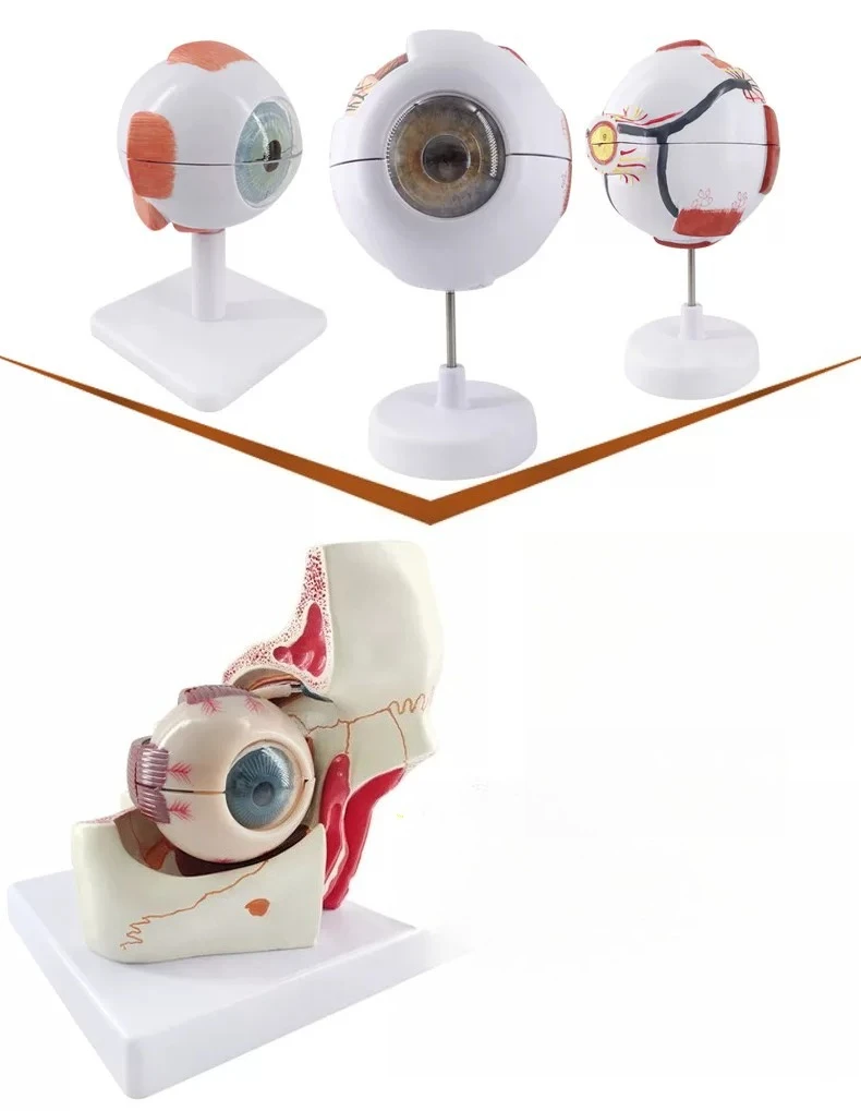 Eye and Orbital Enlargement  Eye and Optic Nerve  Detachable Ten Parts Eye Anatomy 