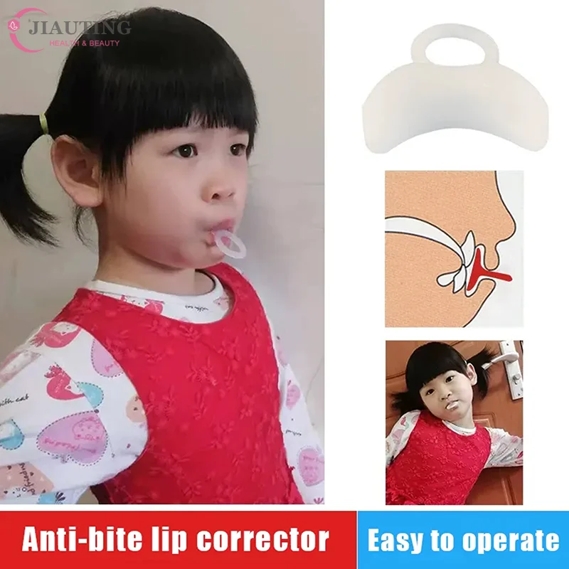 Lip Bite Prevention Device Stop Biting Lip Corrector Improve Oral Correct Facial Muscle Training Mouth Breathing Corrector