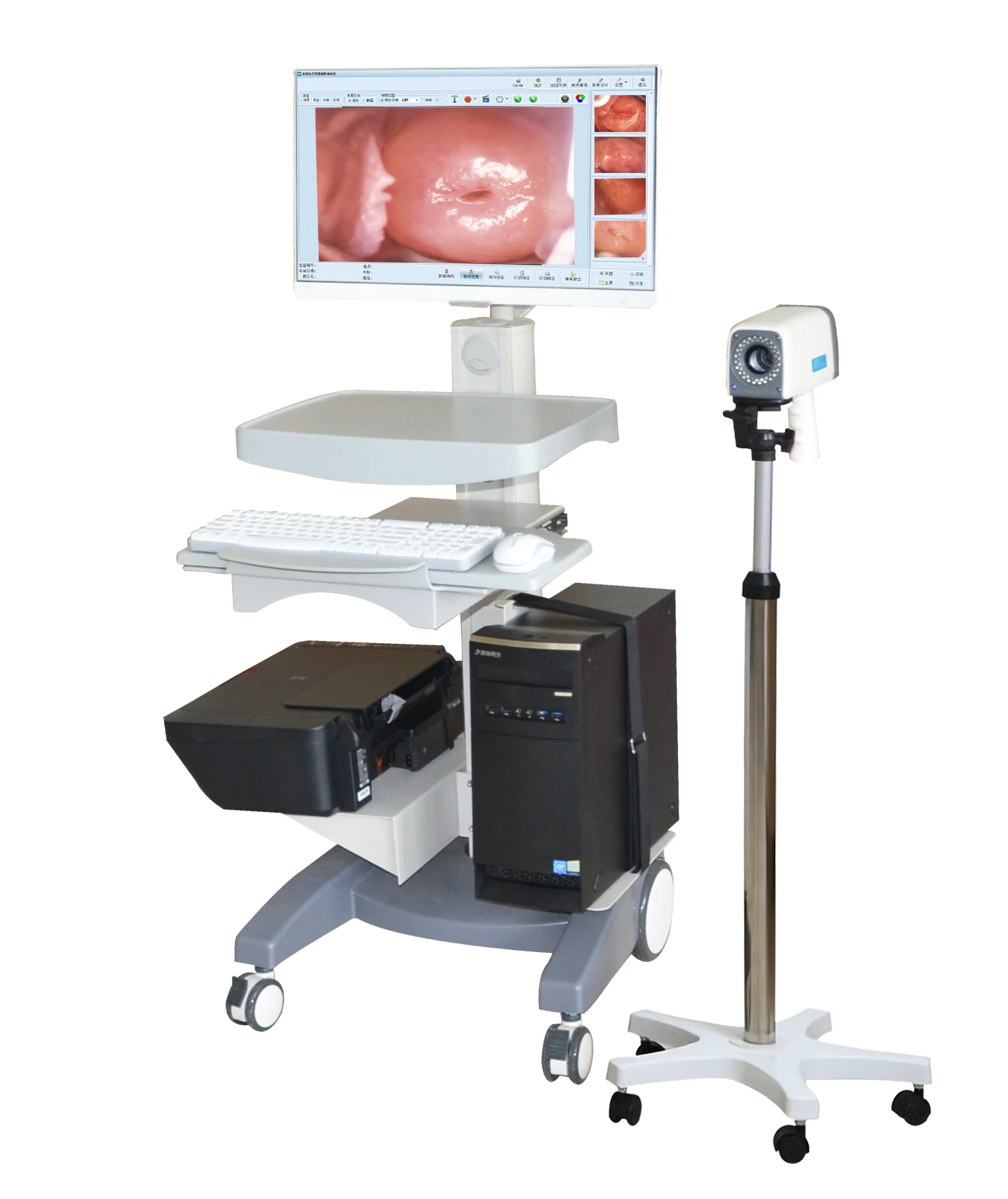 China Supplier Colposcope Gynecology Examination Optical Colposcopy for Clinic