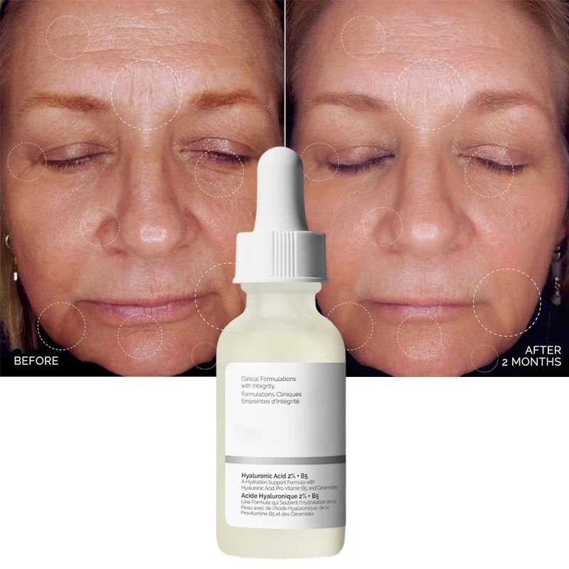 Suero de ácido hialurónico B5, antienvejecimiento con ceramidas, hidratación multide profundidad, Reduce las líneas finas, regordete, cuidado de la piel coreano más suave