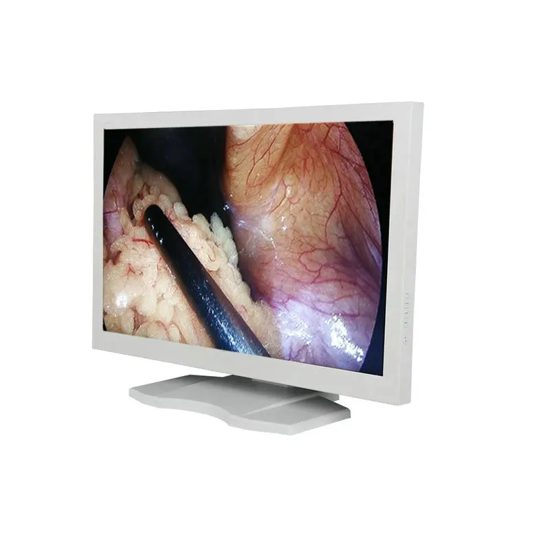 HD endoscopic Hysteroscopy / Artroscopy  Laparoscopy tower surgery equipment CE approved