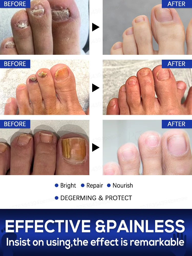 ᴴᵒᵗ ˢᵉˡˡⁱⁿᵍ ᴸᵃˢᵉʳ ᴾʳᵒᵈᵘᶜᵗ ᶠᵒʳ ᔆᵒˡᵛⁱⁿᵍ ᴺᵃⁱˡ ᴾʳᵒᵇˡᵉᵐˢ