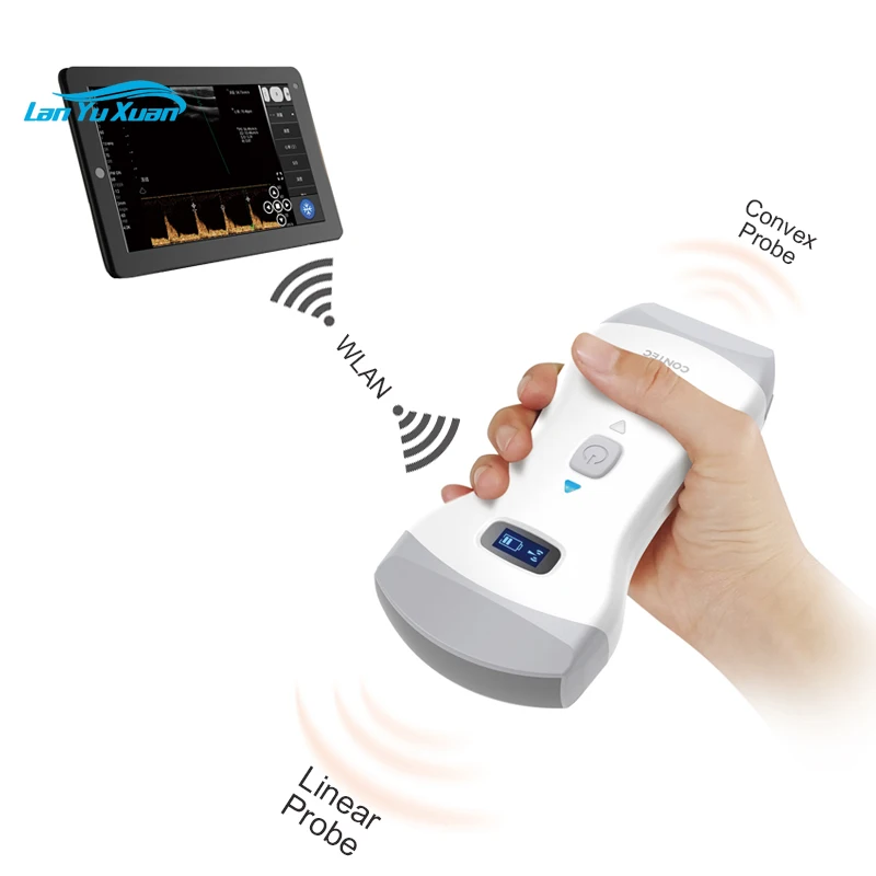 CMS1600B color doppler ultrasound palm ultrasound machine