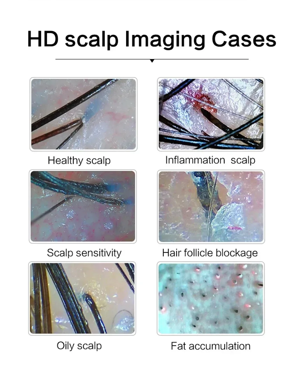 15HD Professional Skin Hair Detector หนังศีรษะรูขุมขน Moisture ผิวรูขุมขน Pigment แว่นขยายเครื่องวิเคราะห์ผิว Pigment Tester