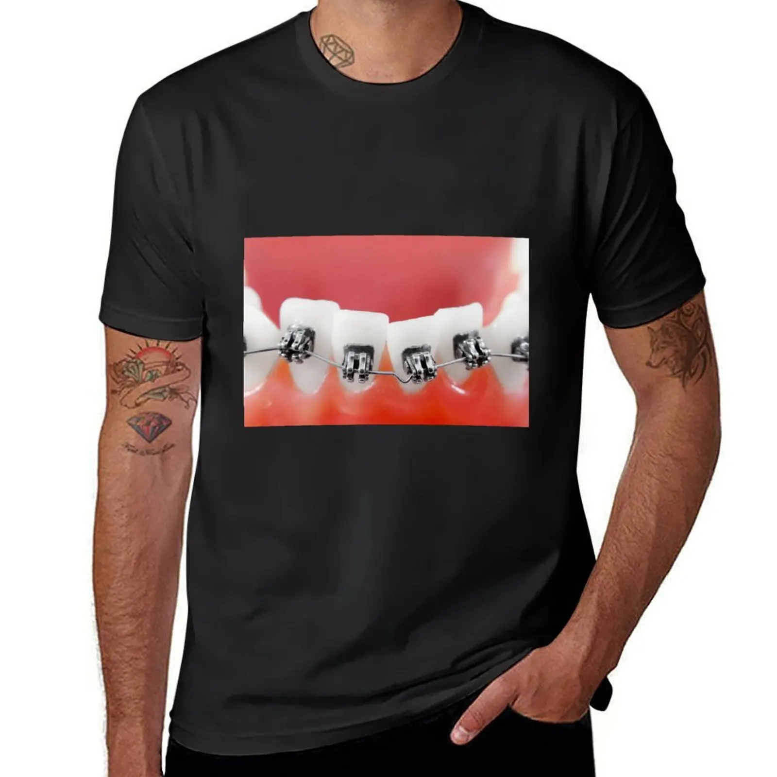 Dental braces T-Shirt graphics korean fashion men clothings