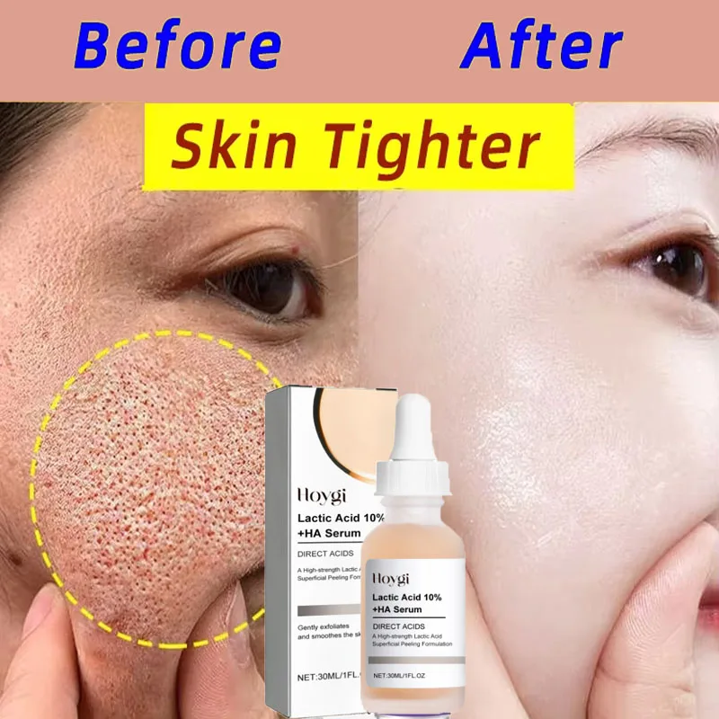 

Pore Shrinking Serum Lactic Acid Remove Blackheads Acne Oil Control Tightening Minimizing Pore Moisturizing Whitening Essence