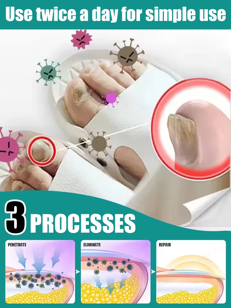 2週間以内に悪いマニキュアは別れを告げる