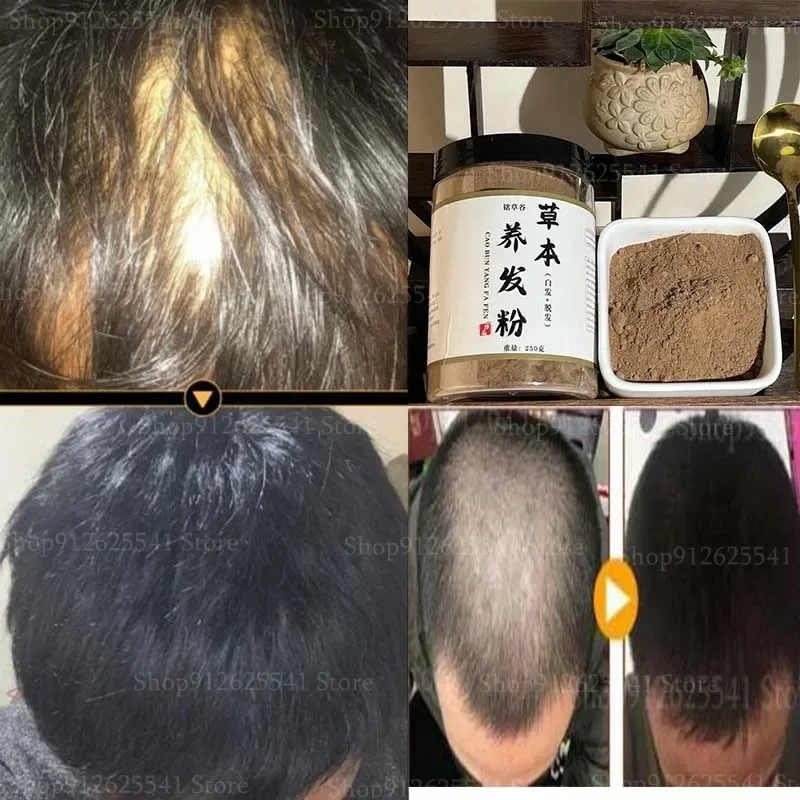 250g Women Men Anti-Hair Loss Hair Growth Hair Thinning Treatment Herbal Hair Care Powder Fast Growing Scalp Treatment Care