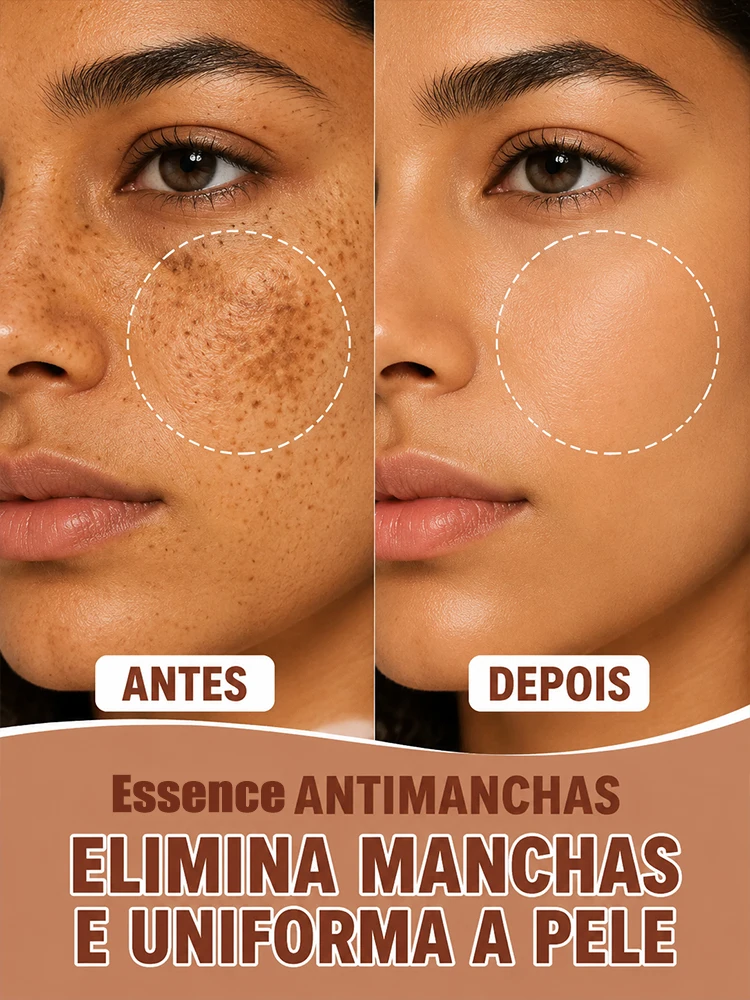 High Effect Melanin Correcting Serum Sun Freckle Remover Dark Spot Blocker Anti Stain Skin Whitening