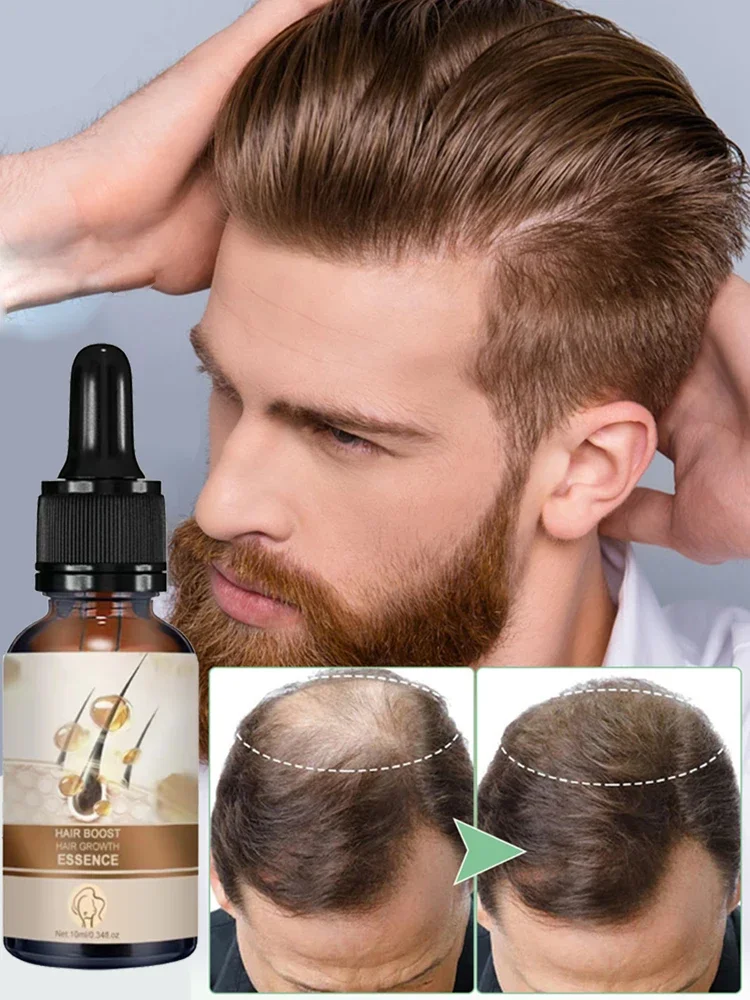 

Hair Growth for Men Women Fast Growing Products Essential Oils Ginger Hair Loss Scalp