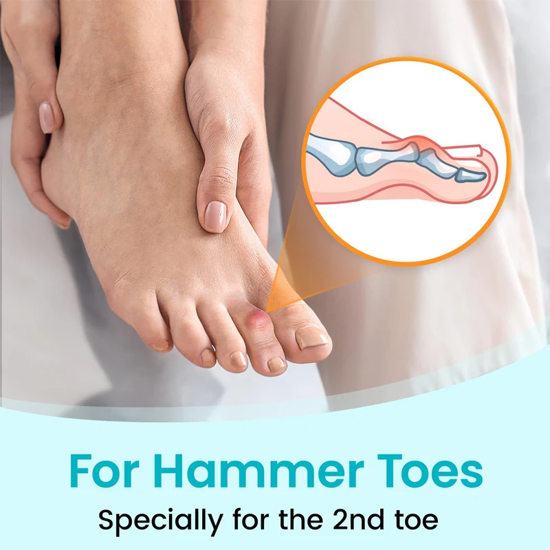1 piece hammer toe splint support foot pad to correct hallux valgus overlap orthotic device