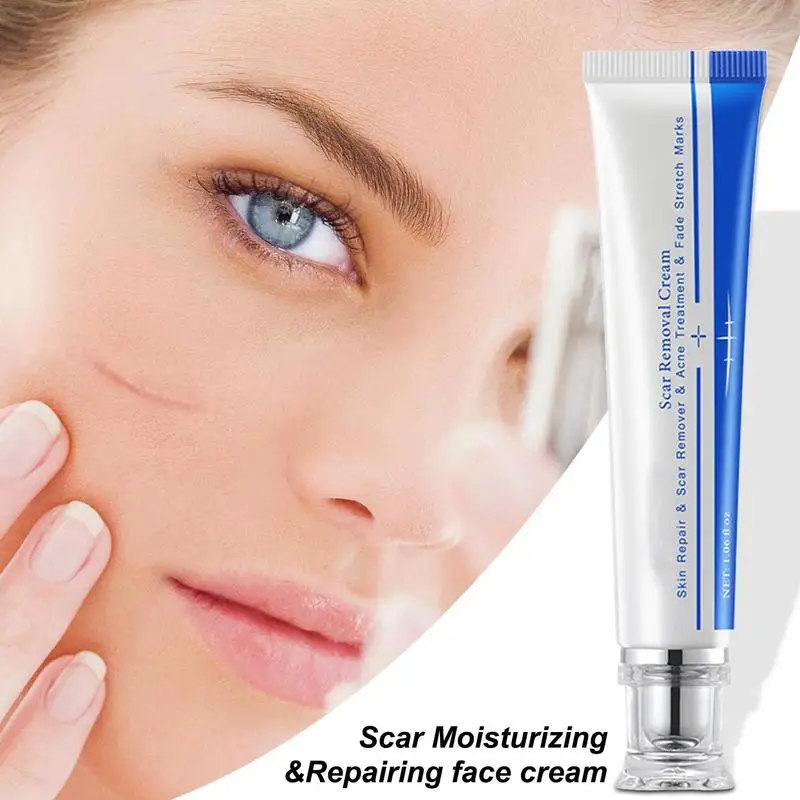 Stretch Mark Cream Scar Cream Scar Away Silicone Gel Scar Gel Silicone Scar Cream Burn Gel For Injury Arms Burns Face Legs