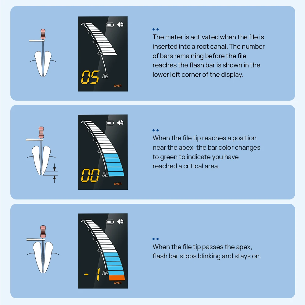 AZDENT Dental Endo Apex Locator Dentistry Endodontics Root Canal Measurement Mini Root Canal Located Instruments Dentistry Tool