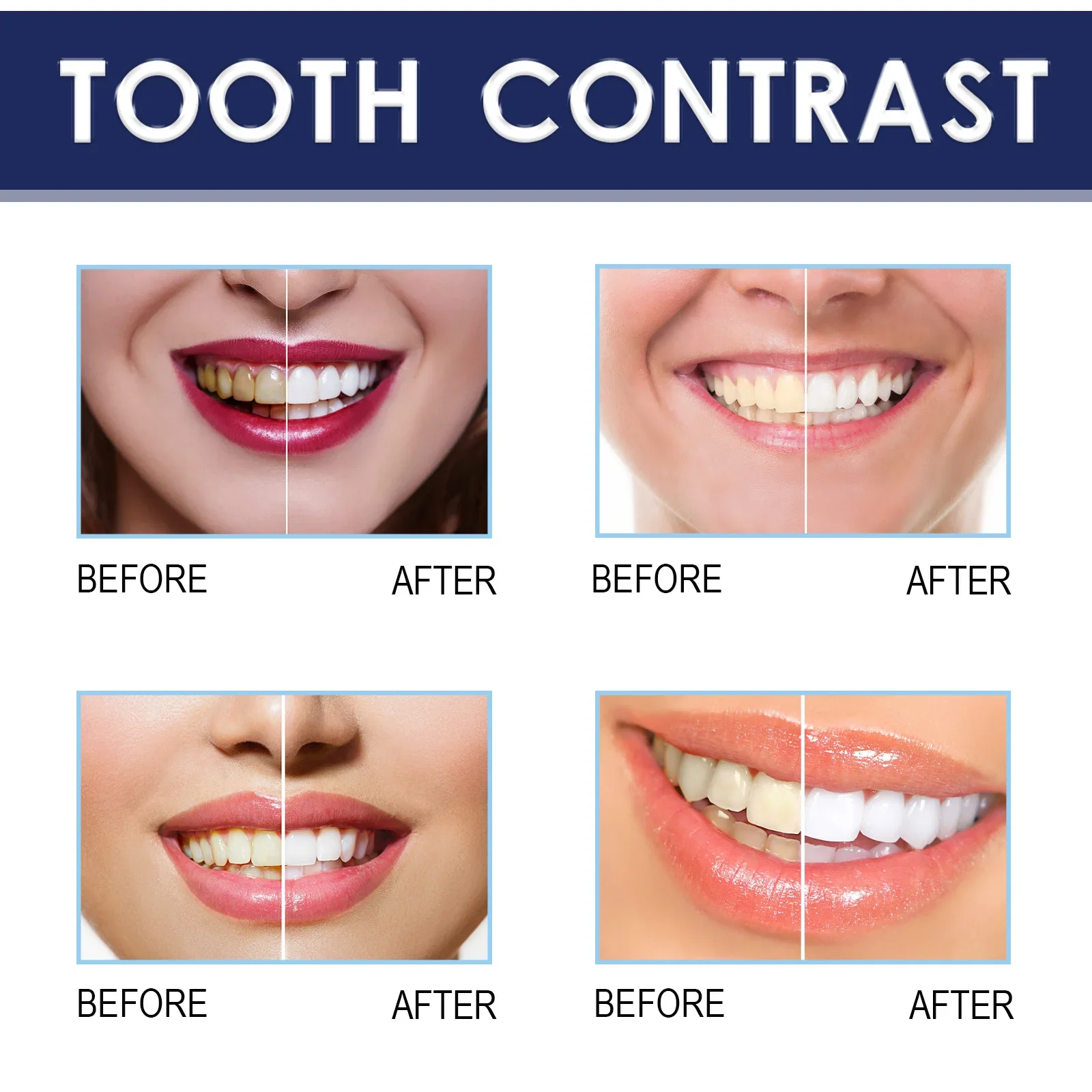 Concentrated Teeth Brightening Essence Pen Effectively Removes Yellow Teeth Cigarette Stains Tea Stains Teeth Whitening Product