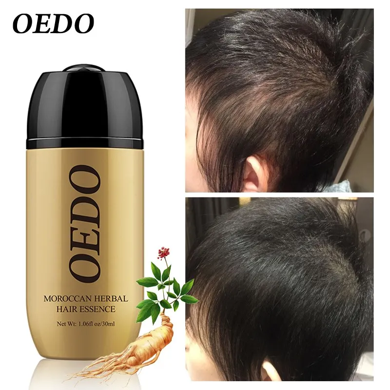 Moroccan Ginseng Hair Growth Essence Oil Quick Repair Hair Root Prevention Hair Loss Product Repair Curly Dry Scalp Care