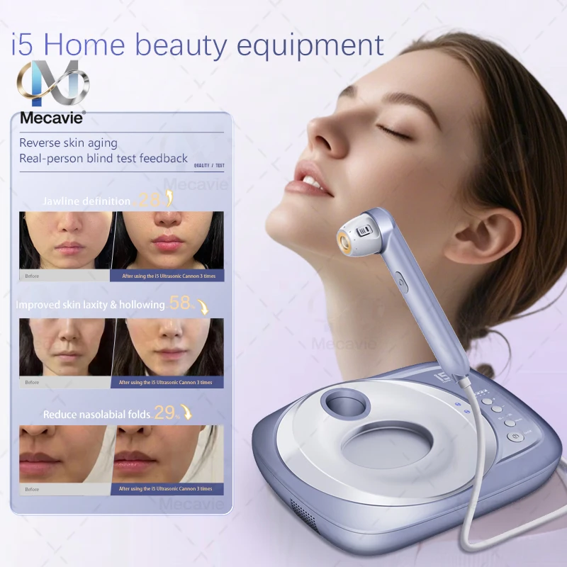 家庭用ミニ超音波フェイスリフティングデバイス、ポータブル、SMAS層をターゲットに、Vラインの顔の輪郭、しわの除去、アンチエイジングに