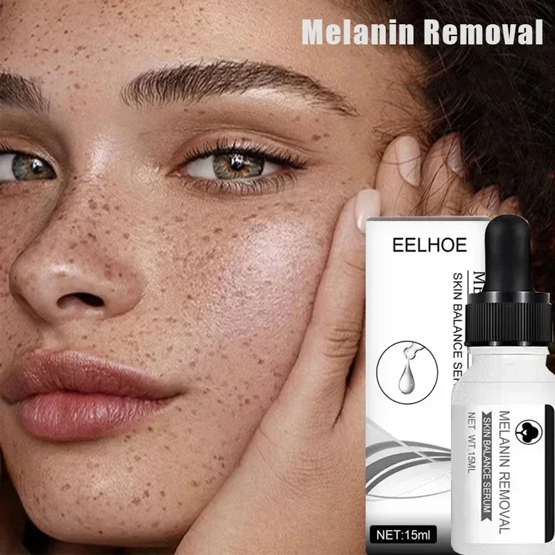 نياسيناميد مزيل البقع الداكنة مصل النمش تبييض الرطوبة إزالة قوية نقطة سوداء الكلف كلف الوجه كريم العناية بالبشرة #2