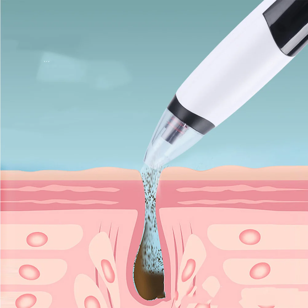Elektryczny oczyszczacz porów z 3 regulowanymi poziomami intensywności i 3 końcówkami ssącymi do głębokiego oczyszczania twarzy, usuwania zaskórników i pielęgnacji skóry.