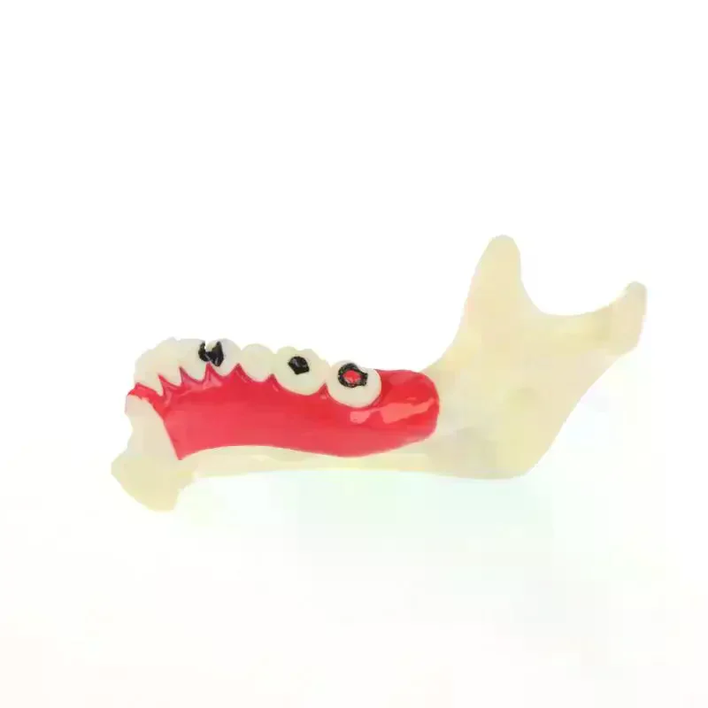 Endodontic Treatment Model Anatomy Of Gums Mandible Tissue Anatomical Model Dentist Teach Study Demonstration Teeth Model Denta