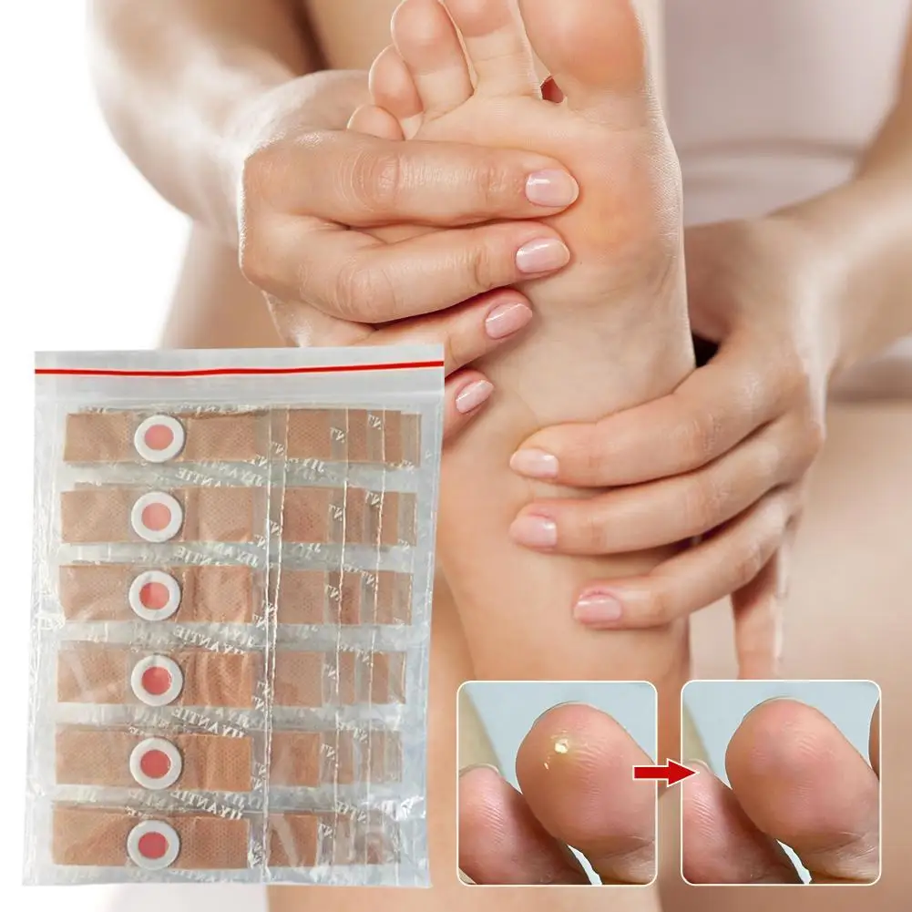 

Пластыри для ухода за мозолями на ногах, кукурузные пластыри для удаления мозолей и кожи, клейкие обезболивающие подушечки для мозолей на ногах, дышащие