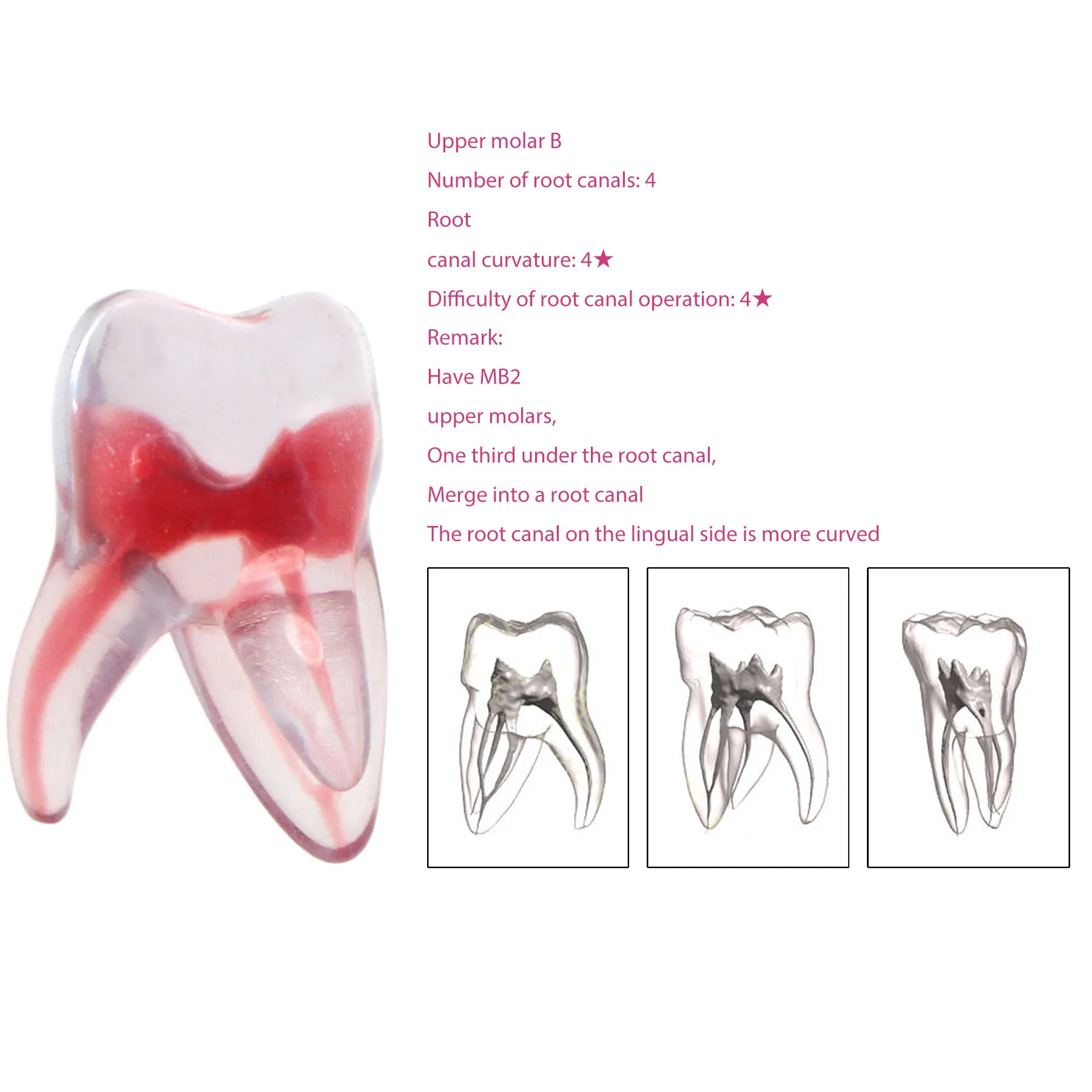 

Dental Root Canal 3D Model Practice Model Root Canal Therapy Resin Model Endodontics RTC Upper Molar B