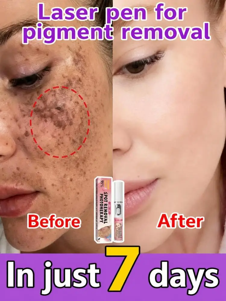 Compact Skin Appearance Care Pen, Help Improve Dark Spot‑Looking Facial Skin, Even Dull Uneven Complexion, Easy‑Operate Handheld Beauty Device for Women Home Skincare Routine