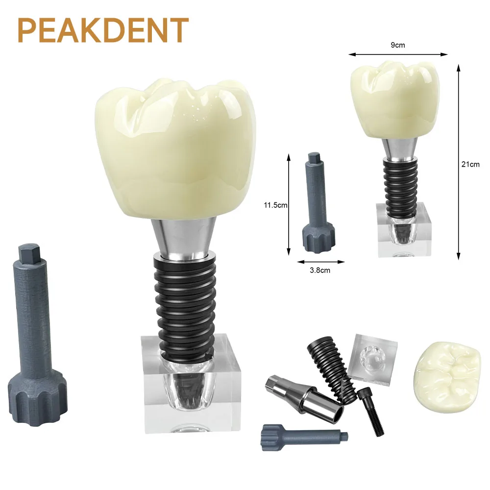 

Transparent dental implant model detachable crystal dental implant teeth model for teaching study and practice training