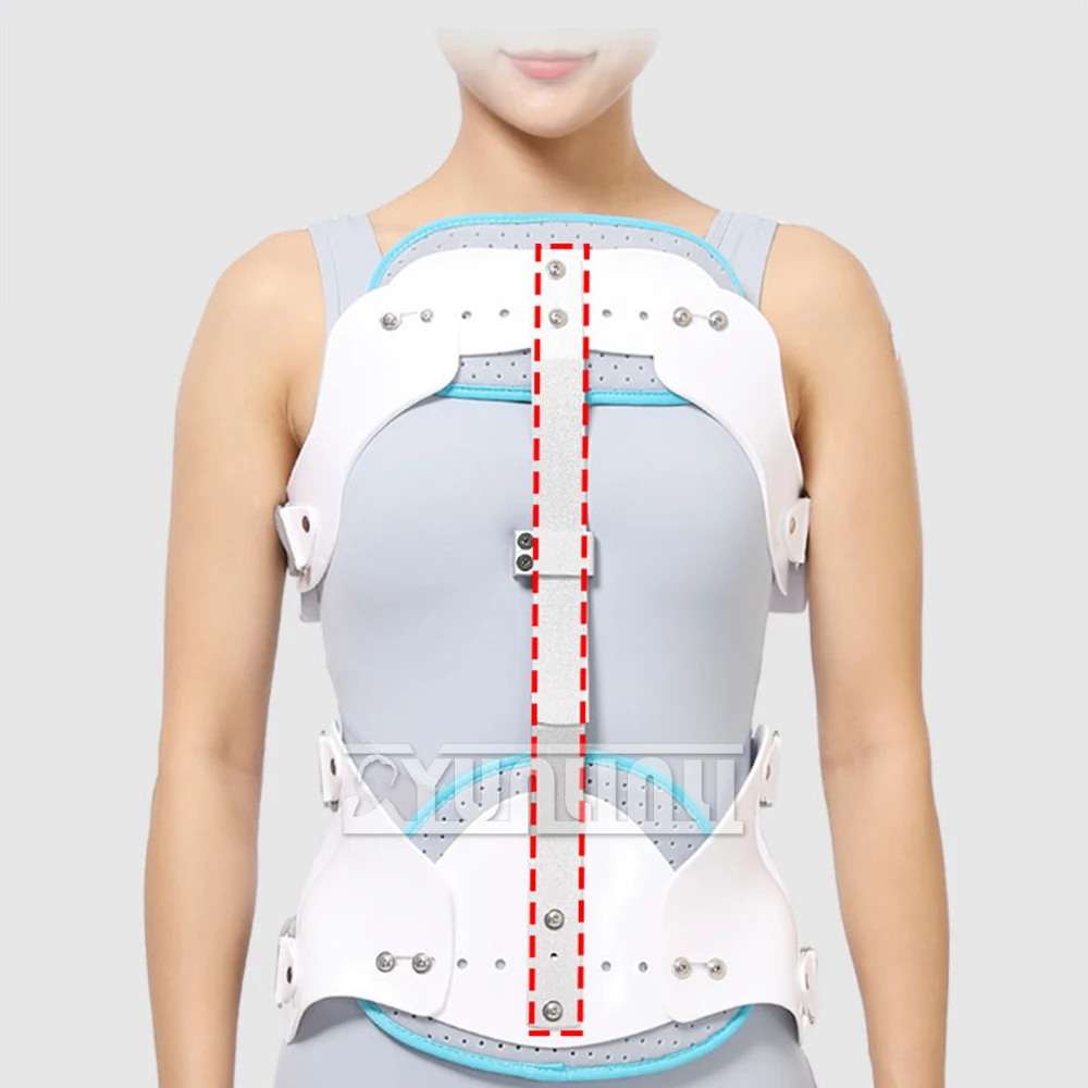 Thoracolumbar Spine Fixation Brace Lumbar Thoracolumbar Spine Protector Postoperative Fixator