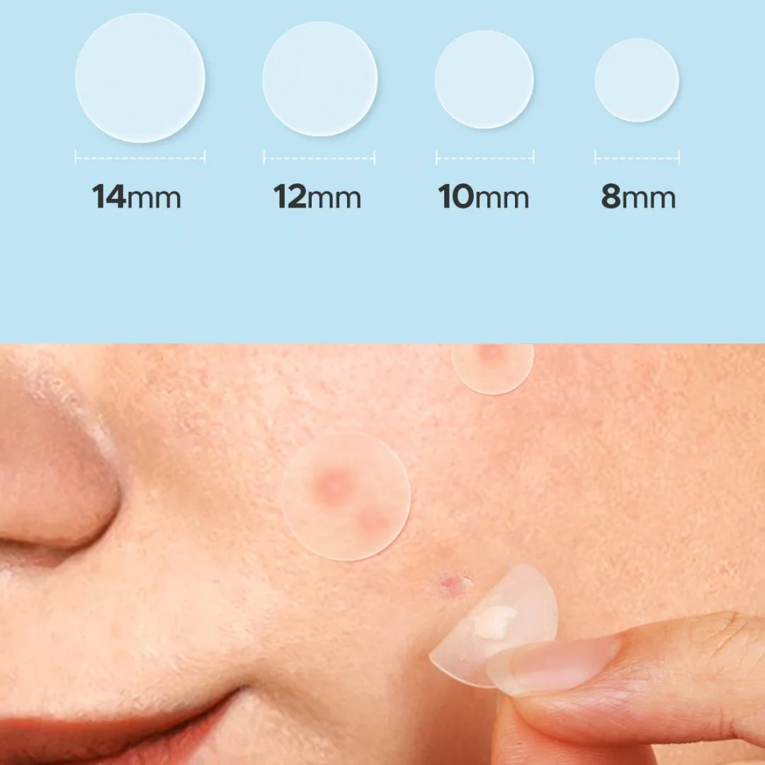 360 misturando perfeitamente dos remendos da acne. Ultra-suave, impermeável e respirável para cuidados duradouros em toda a pele.