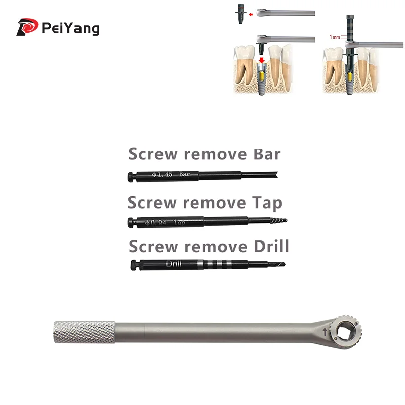 Dental Total Remove Kit Tool - Screw Bar/Tap/Drill Broken Screw Remover Kit Fixture Extraction Tool Kit Bone Expander Set Wrench