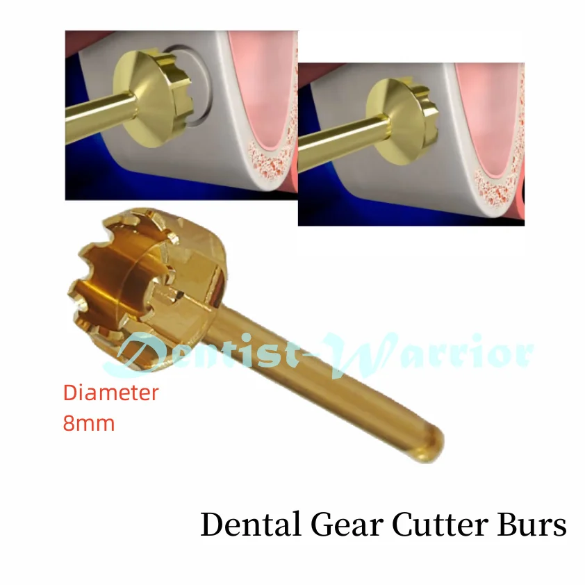 Dental Sinus Lift Lateral Approach Trimmer Drill Cutter Burs Fits DASK Surgident