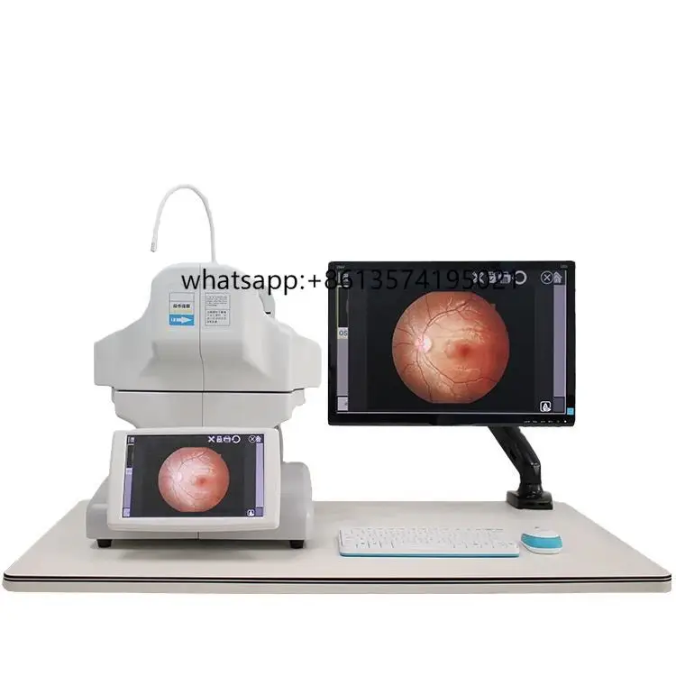 Fundus oftálmico retinal não midriático oftálmico totalmente automatizado com alta qualidade