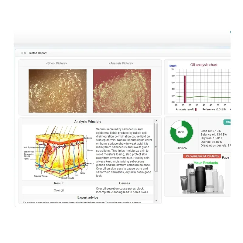 Digital facial skincarisma scope 3 layer 3D visa skin analysis dermaskin logica machine connect with computer use