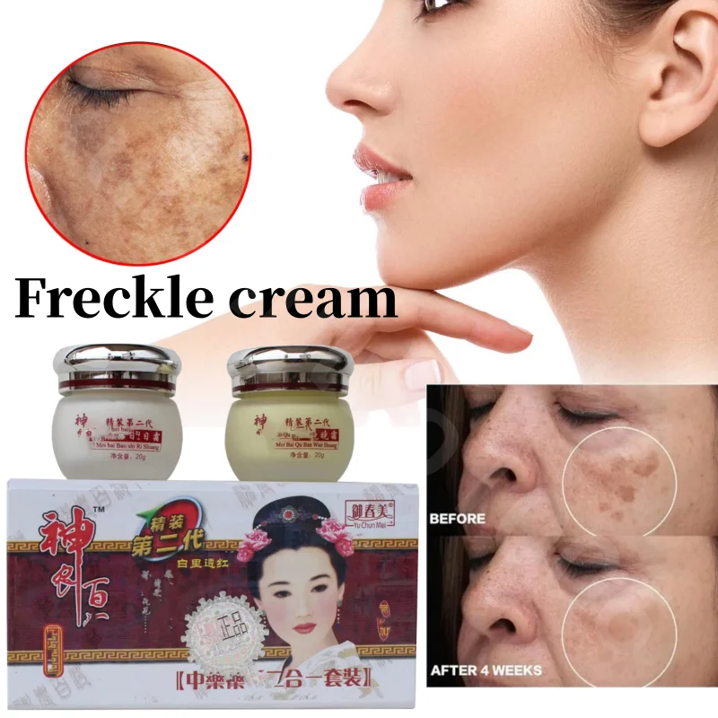 

Best Face Whitening Freckle Cream Kit Remove Dark Spots Melasma Age Spots Acne Pimples Skin Care Set