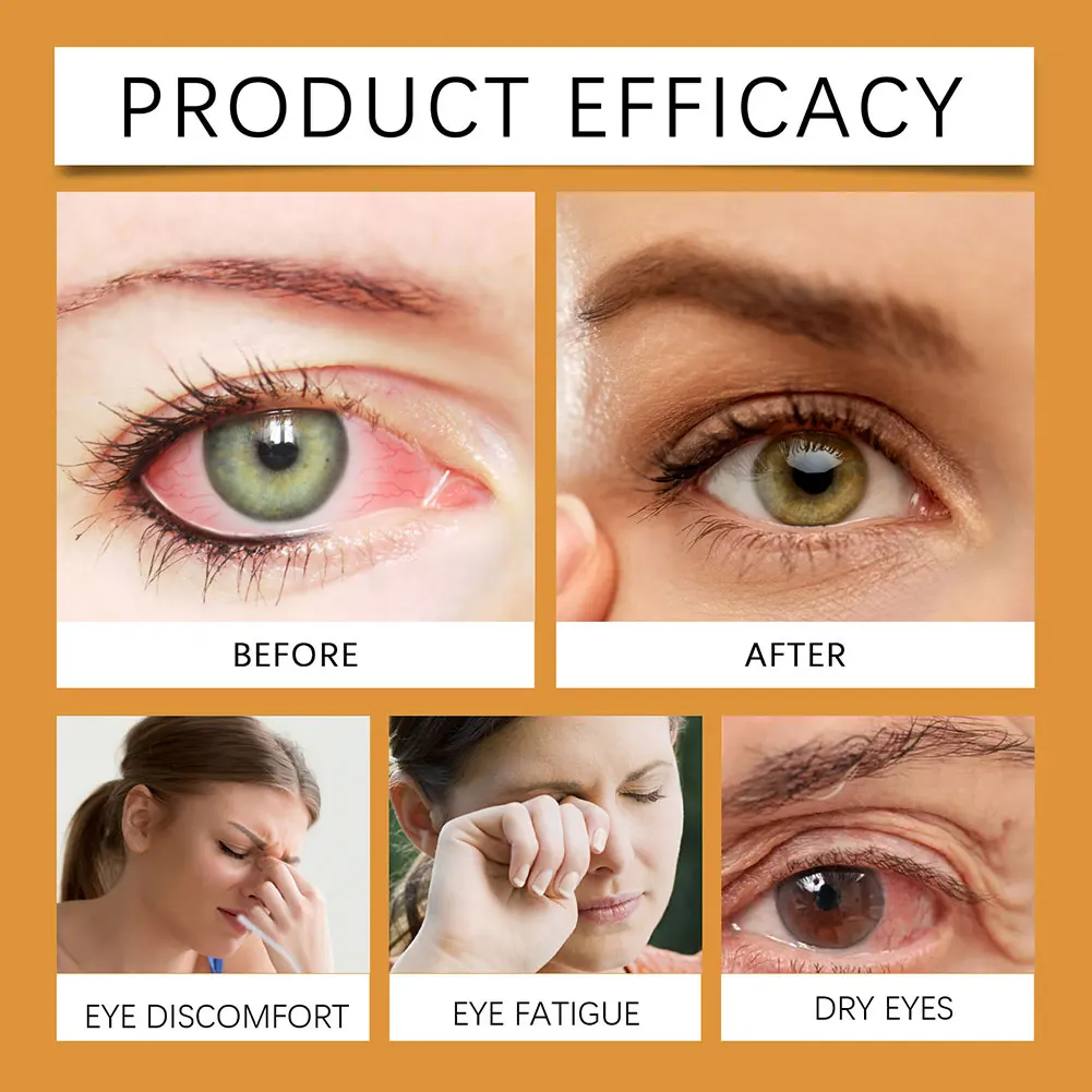 Honey Eye Drops For Optimal-Vision Relieve Eye Fatigue Dryness For Home/Travel
