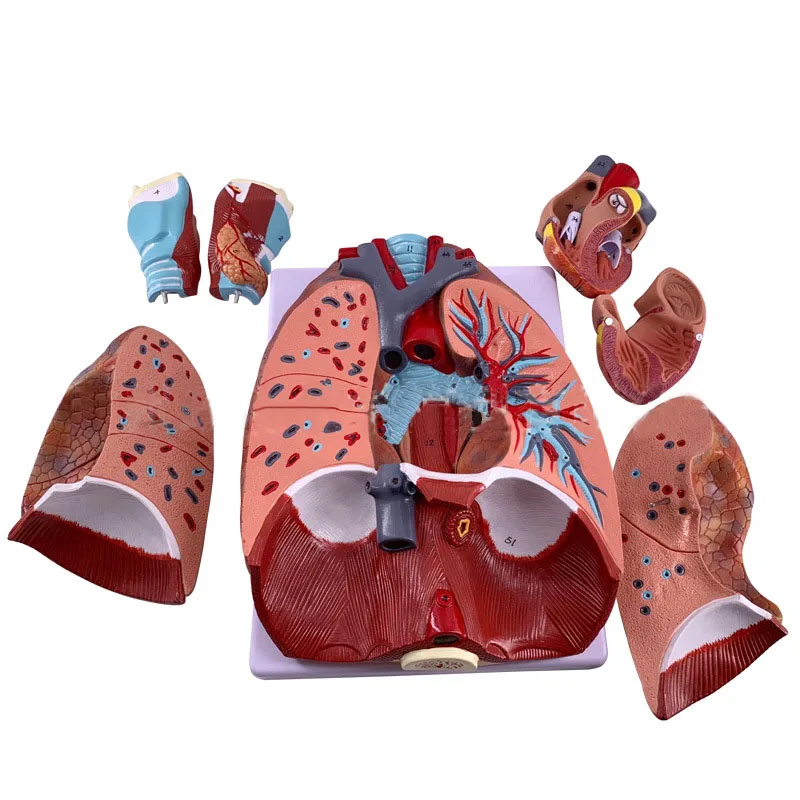 Imagem -03 - Modelo Anatômico Humano Modelo Médico Anatomia Pulmonar Sistema Respiratório Material Docente Laringe Coração Pulmão