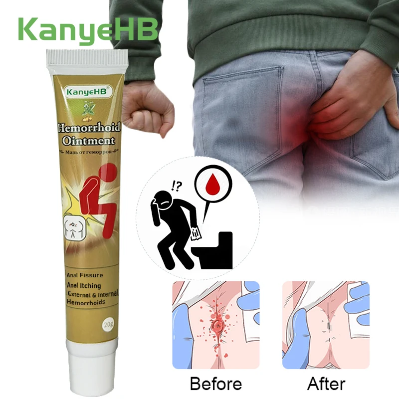 1Pcs Hemorrhoid Treatment Cream Removal Internal External Hemorrhoid Anal Fissure Bloody Chinese Medicine Pain Relief Cream G003