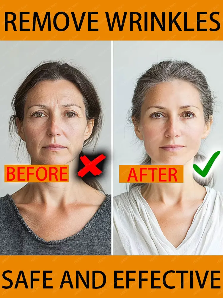

Laser Product To Solves wrinkle troubles-