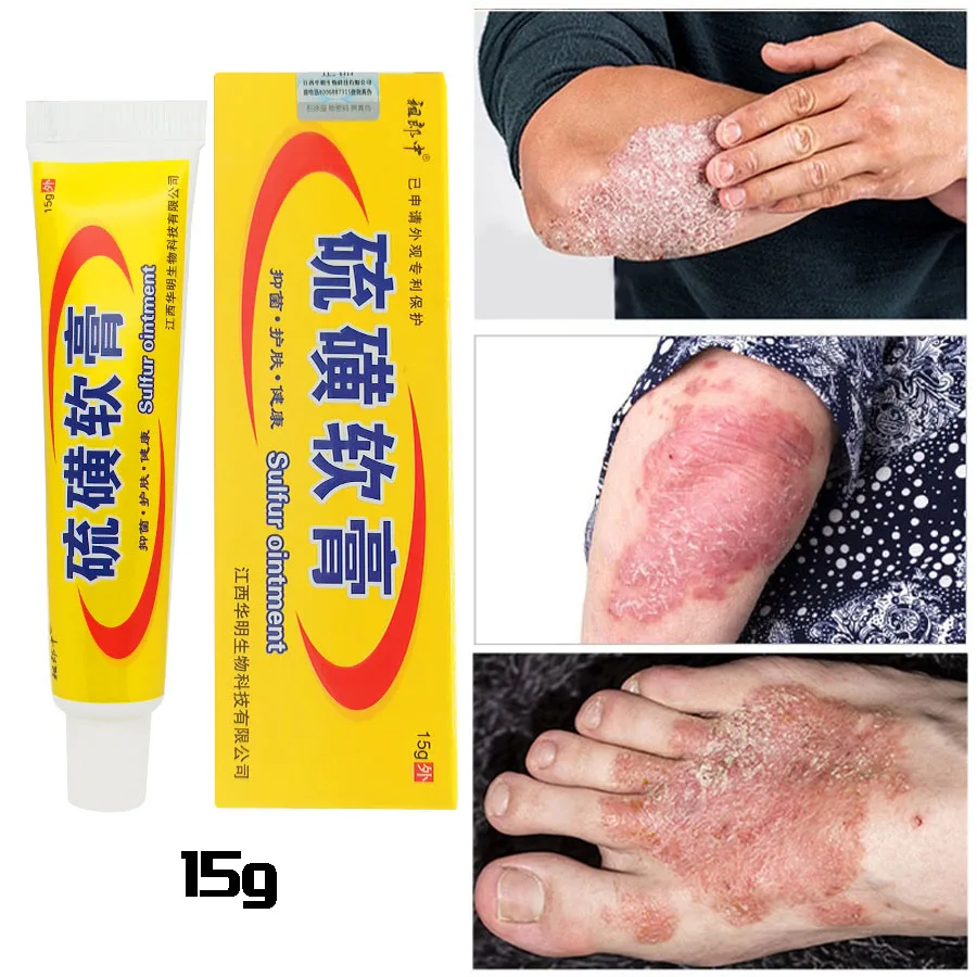 Shanghai Sulfur Soap Oil-Control Acne Antibacterial Treatment Psoriasis Seborrhea Eczema Anti Fungus Bath Healthy Soaps Eczema