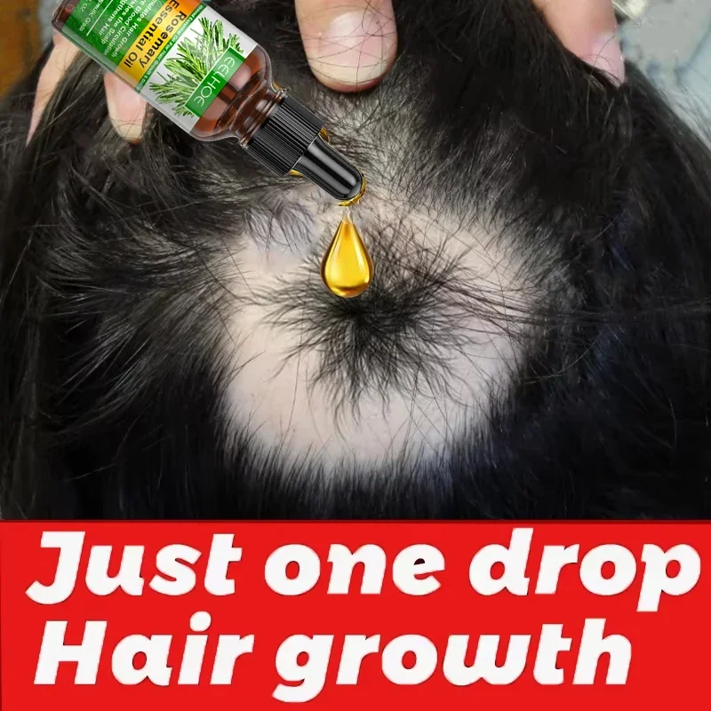 

Rosemary Hair Growth Essential Oil Fast Repair Baldness Anti Hair Loss Products Hair Regrowth Scalp Treatment Serum Men Women