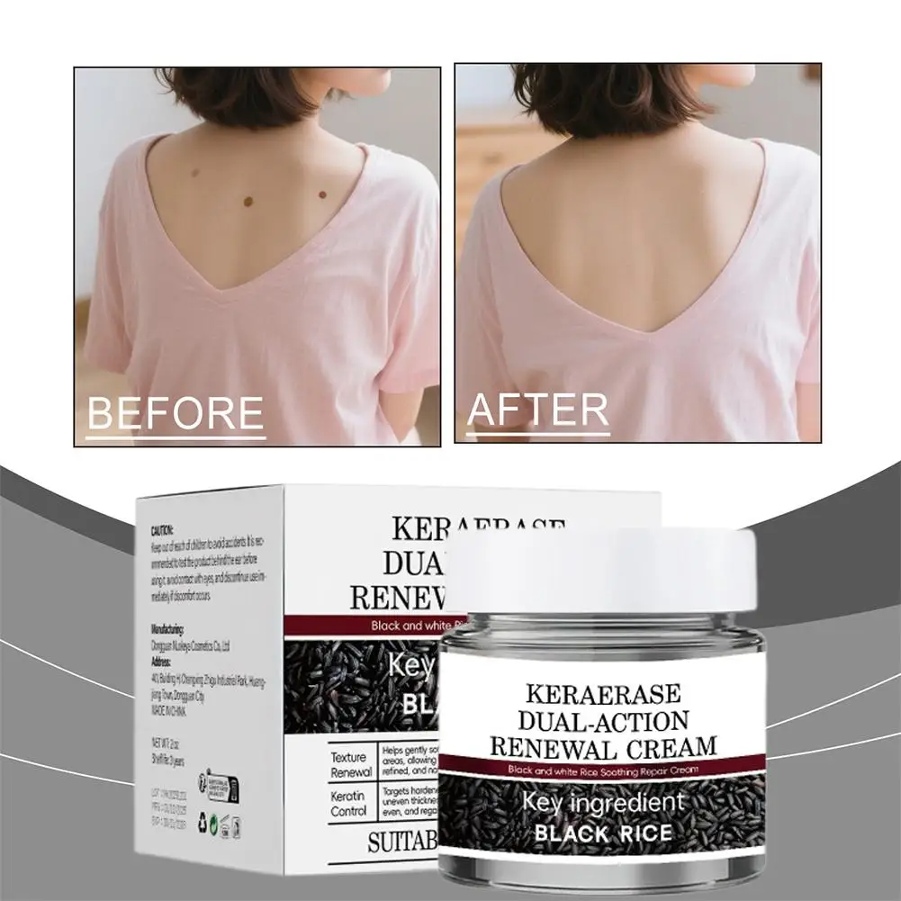 Black Rice Raw Pulp Moisturizing Cream - Hydrates, Evens Skin Tone, Reduces Fine Lines With Rice Extract & Hyaluronate Face Care