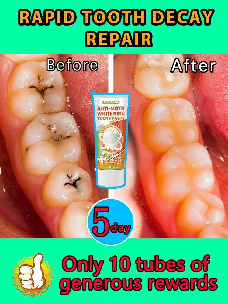 Clarear Reparação De Creme Dental, restauração Dente